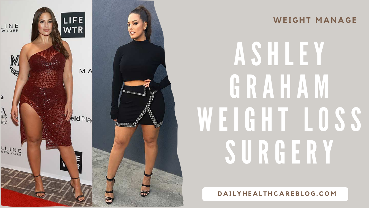 Ashley Graham Weight Loss Surgery
