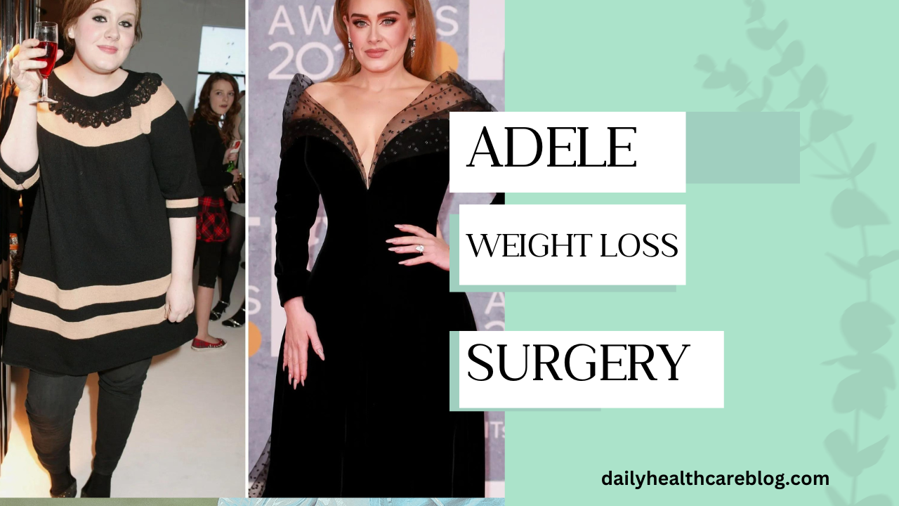 Adele Weight Loss Surgery