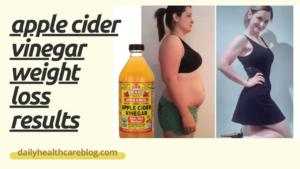 apple cider vinegar weight loss results