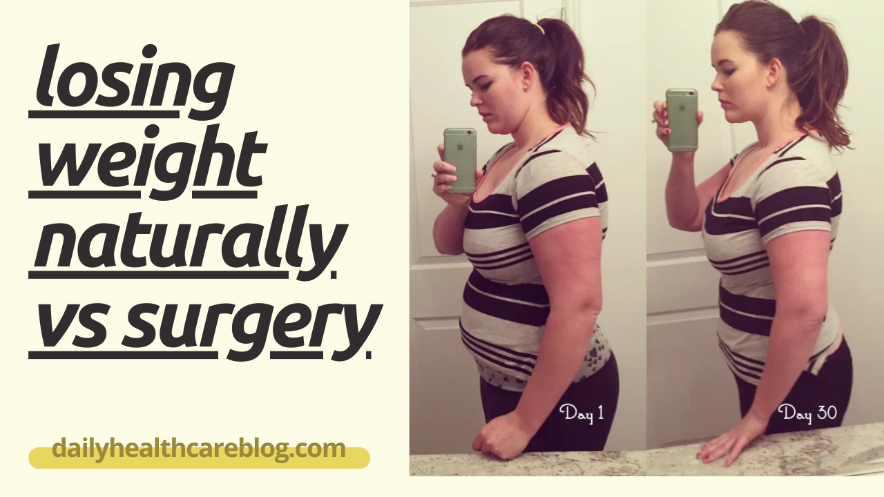 losing weight naturally vs surgery